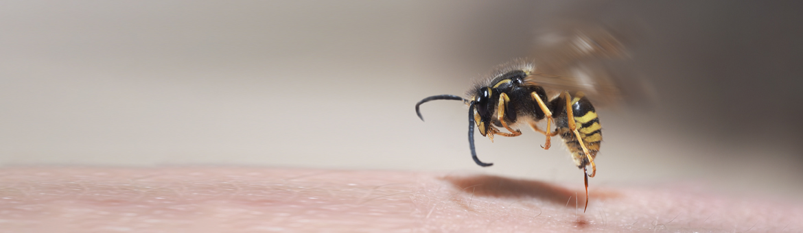 stinging yellow jacket